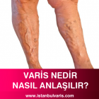 Varis