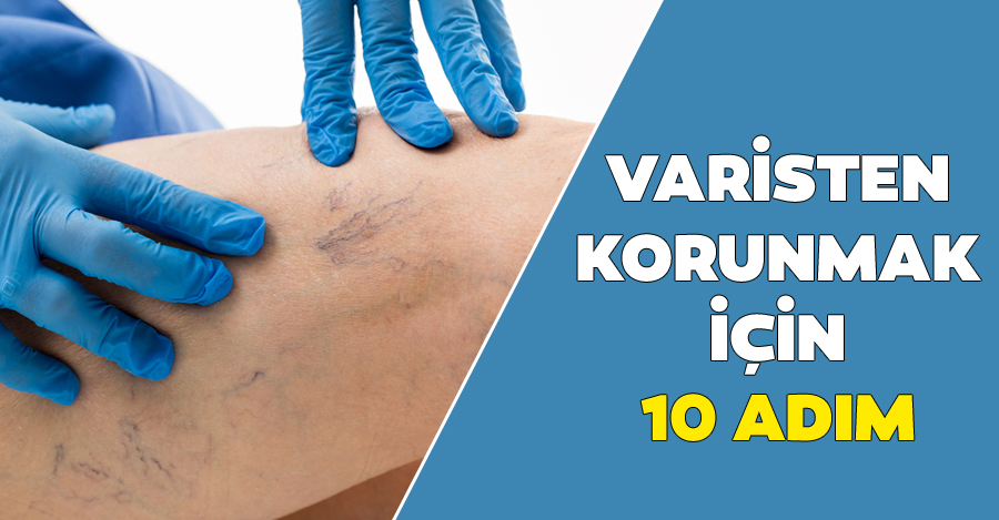 varisten korunma yolları