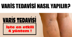 Varis hastalığı tedavi